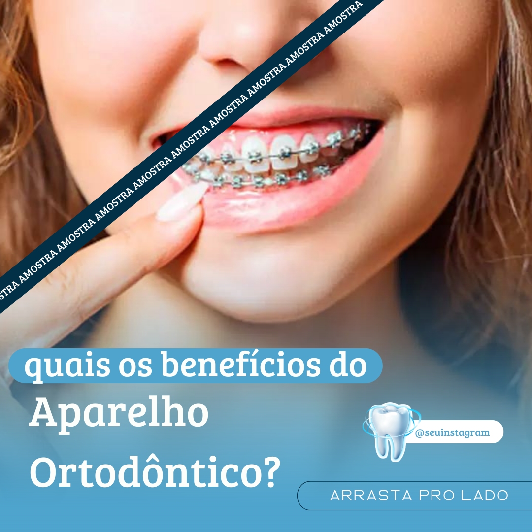 Canva Pack para Dentistas - Imagem 6